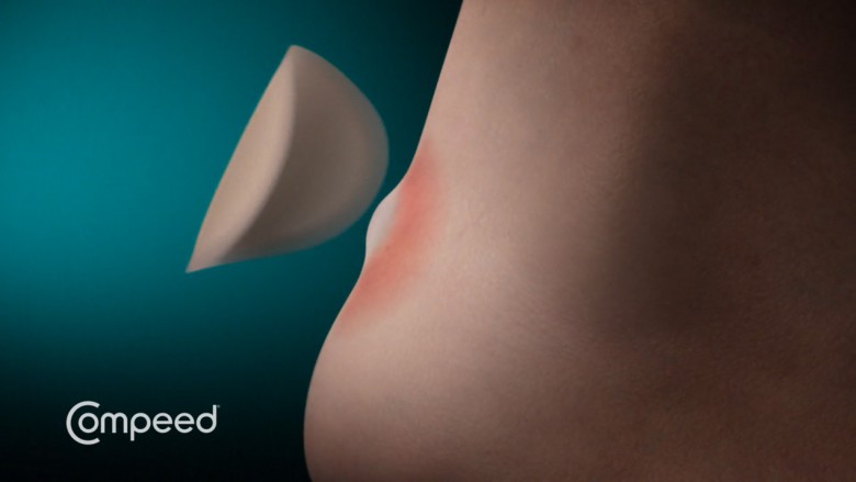 Hidrokolloid technológia